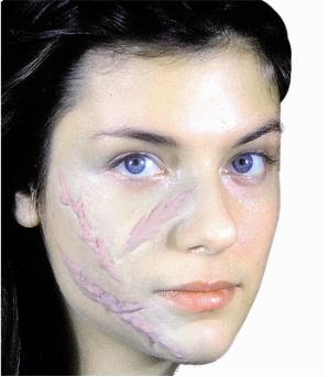 Woochie 3 Raised Scars Prosthetic Makeup Set